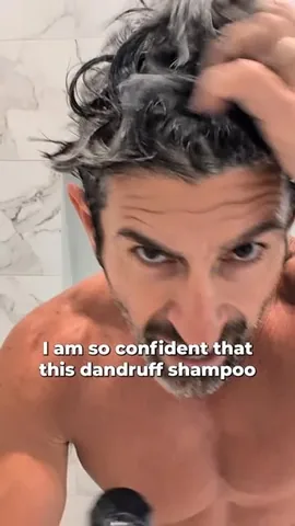 aaronmarino Instagram post about Dandruff treatment