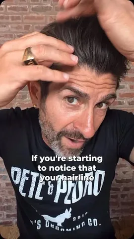 aaronmarino Instagram post about Hair loss treatment