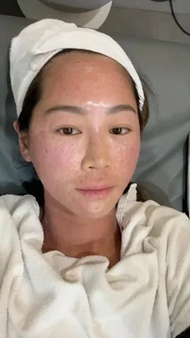 aimeesong Instagram post about Aesthetic skincare treatment