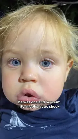 elayna.carausu Instagram post about Childhood allergies