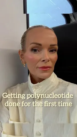 georgina_patient Instagram post about Aesthetic treatment