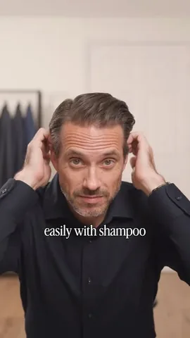 hespokestyle Instagram post about Hairline appearance