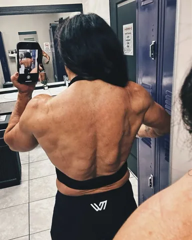 ifbbprocherylmears Instagram post about Nutrition with Short Bowel Syndrome