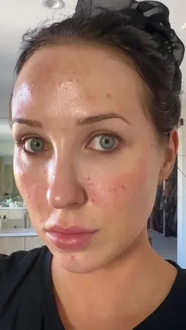 jaclynhill Instagram post about Skincare routine
