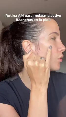 jessicabarboza1 Instagram post about Melasma