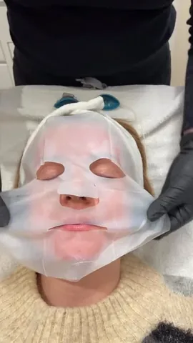 _kellygooch Instagram post about Moxi Laser treatment