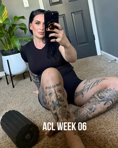 krispy_kremez Instagram post about ACL recovery