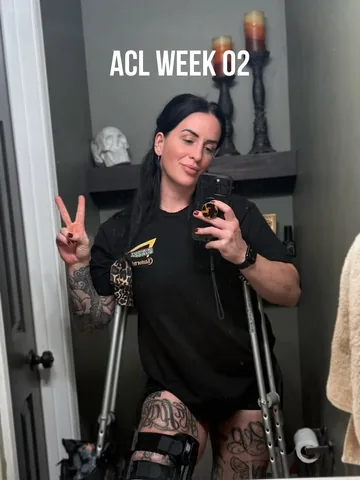 krispy_kremez Instagram post about ACL recovery