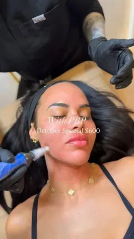 leticiamariegardner Instagram post about PRP facial promotion