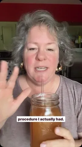 marylenaburg Instagram post about Medical procedure experience