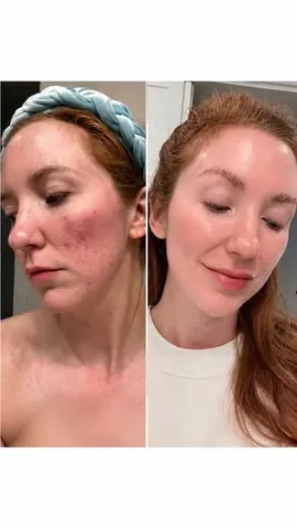 moriahcrobinson Instagram post about Glowy skin skincare routine