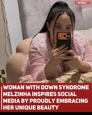nonstop12 Instagram post about Disability representation