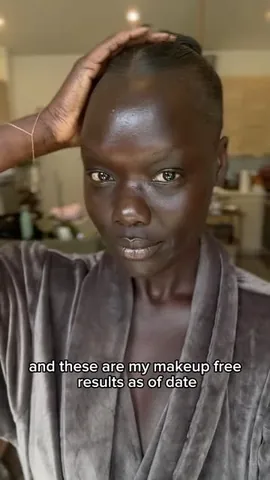 nymatang Instagram post about Aesthetic treatments