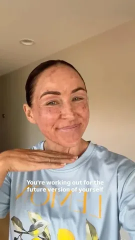 paleomg Instagram post about Profractional laser treatment