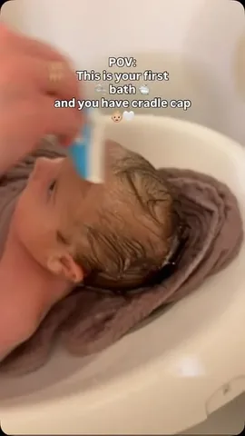 pehotinalifestyle Instagram post about Cradle cap
