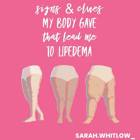sarah.whitlow_ Instagram post about Lipedema symptoms