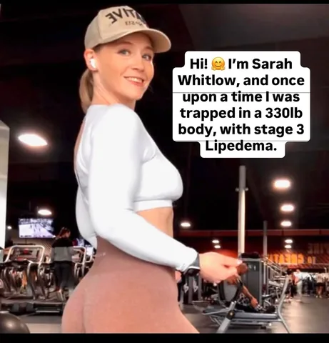 sarah.whitlow_ Instagram post about Personal lipedema transformation