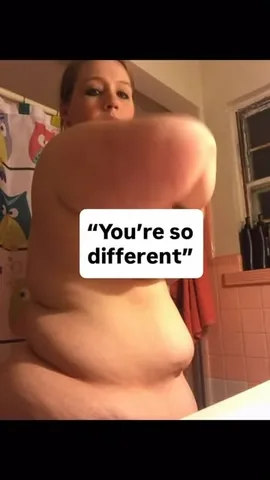 Sarah Whitlow || Founder: Lipedema Movement & Fitness LLC Instagram post thumbnail