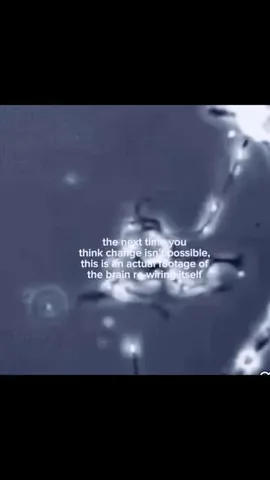 shamelesspsychiatrist Instagram post about Neuroplasticity and ketamine therapy
