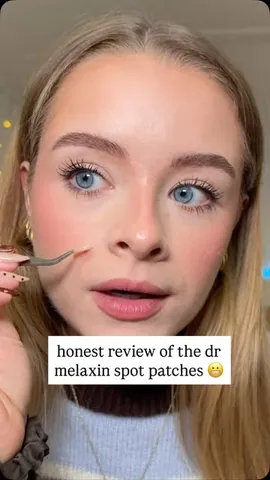 soph Instagram post about Blemish spot patch review