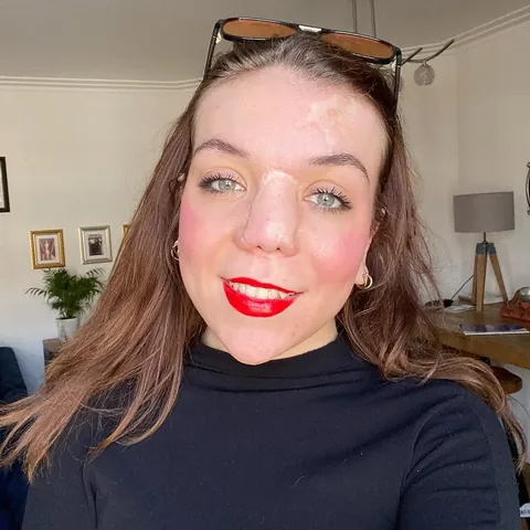 speakinguptoday Instagram post about Personal autonomy