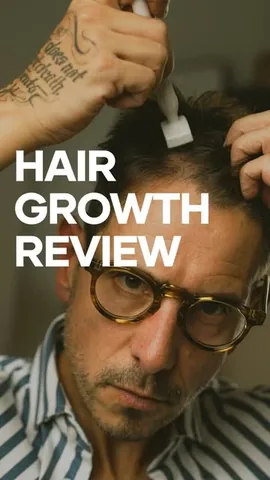 whatmyboyfriendwore Instagram post about Thinning hair treatment