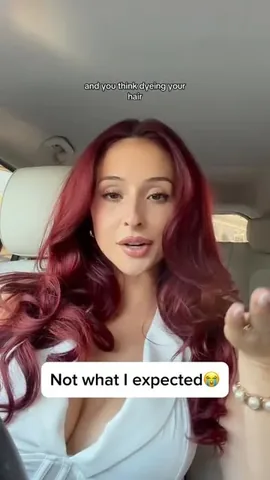 xtheromanempire Instagram post about Alopecia wordplay