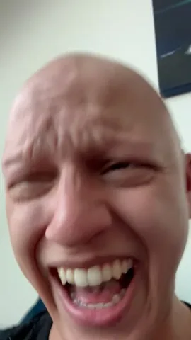 xtheromanempire Instagram post about Alopecia humor