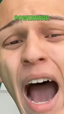 xtheromanempire Instagram post about Alopecia humor