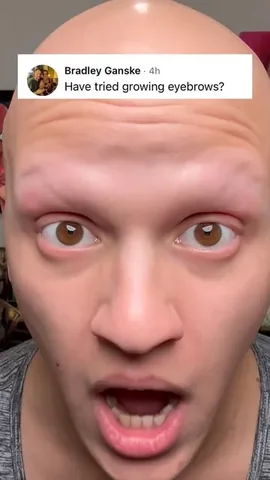xtheromanempire Instagram post about Alopecia satire